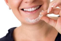 invisalign dentist severna park md