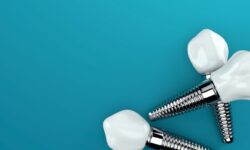 implant dentistry treatment options